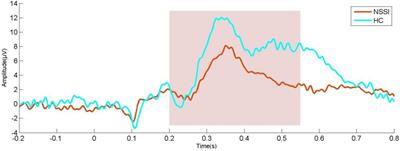 Prefrontal cortex neural activity predicts reduction of non-suicidal self-injury in adolescents with major depressive disorder: An event related potential study